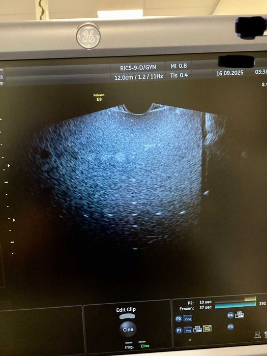 RIC5-9D - Sonda transvaginala 3D/4D Voluson E8 / E10 General Electric