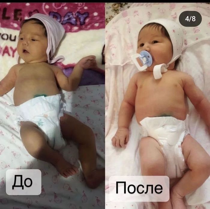 Аренда лампа от желтушки. Билитест. Все виды!