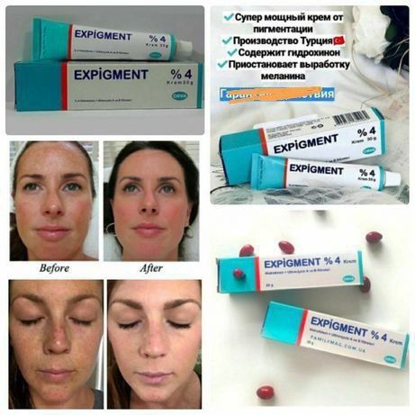 Expigment krem original