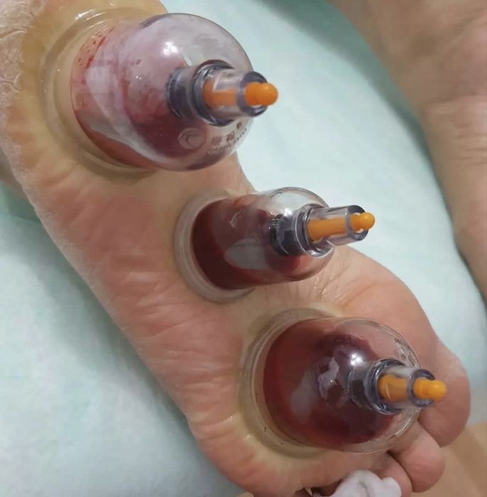 Оздоровительная хиджама