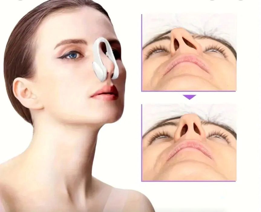 Силиконов клипс за оформяне на нос след Ринопластика