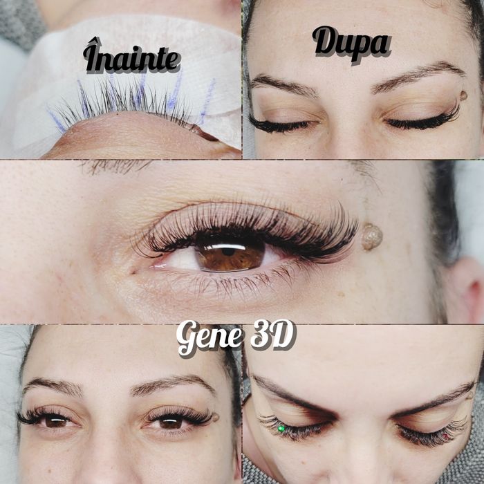 Gene fir cu fir 1D-3D Pensat Epilat