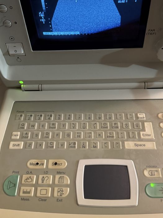 Узи аппарат б/у в рабочем состоянии.