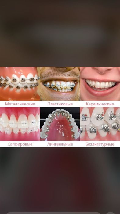 Обмен,бартер варианты !!!