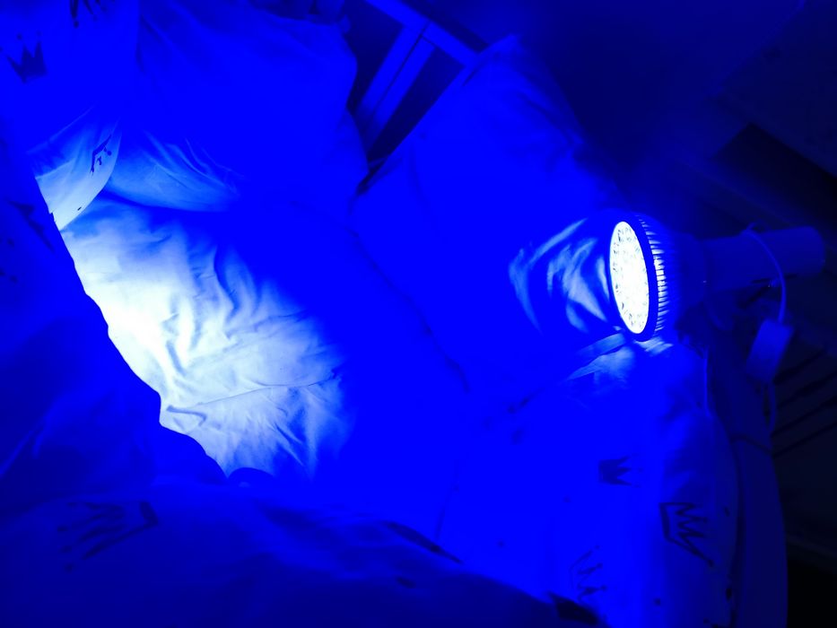 Фотолампа от желтухи куніне 1700 тг