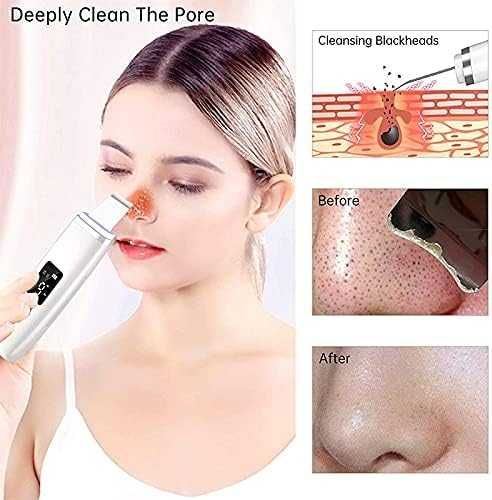HICITI  Уред за дълбоко почистване на лицето с 4 режима на работа