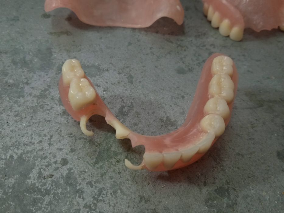 Протез починю своими руками