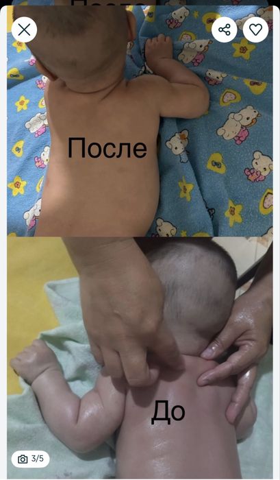 Детский( сәбилер) массаж емі, электрофорез парафин