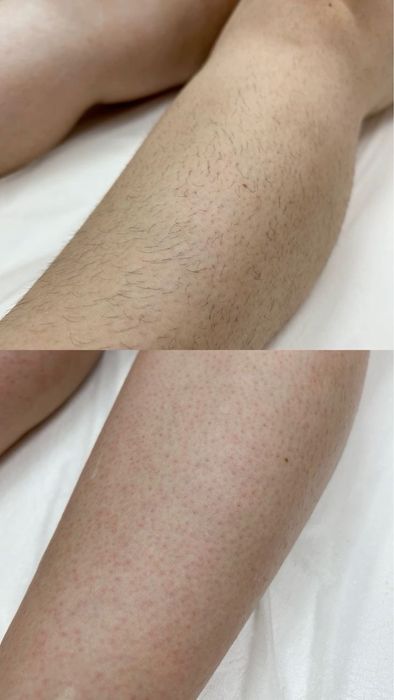 Ламинация и депиляция