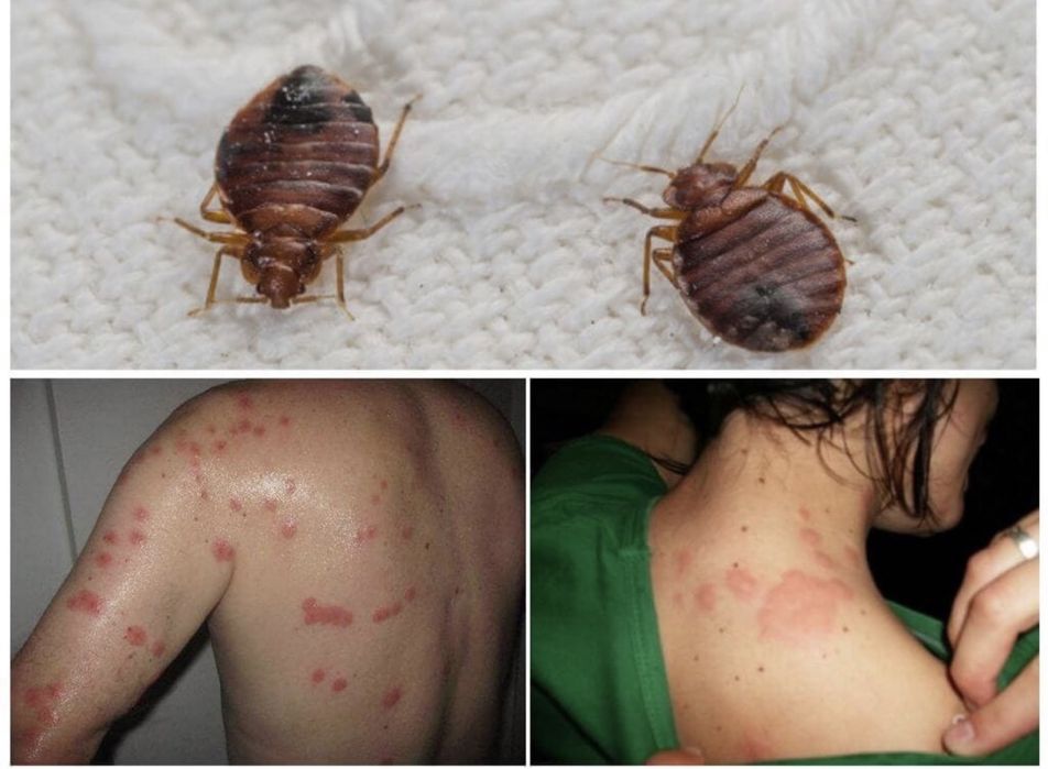 20% СКИДКА! Дезенфекция дизенфекция дезинфекция дизинфекция dizinfeksi