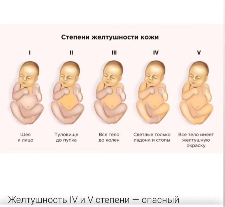 Фото лампа от желтухи