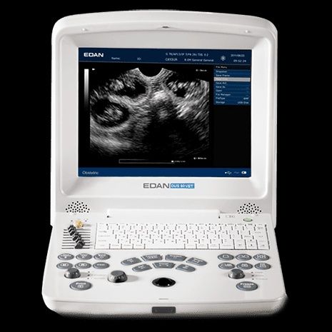 Продается аппарат УЗИ ЭДАН-60