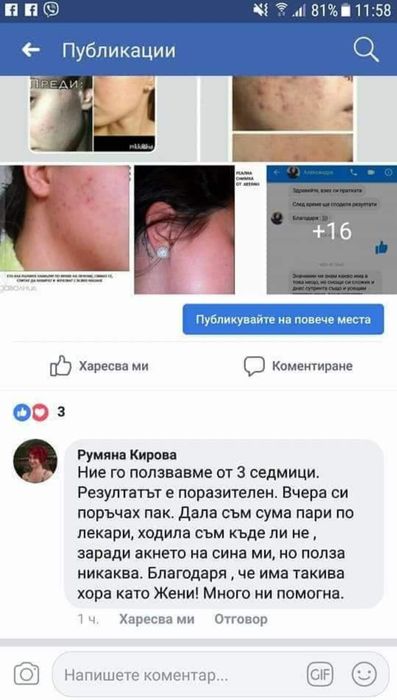 Лосион Против Акне, Мазна Кожа, Разширени Пори и Херпеси - 100мл