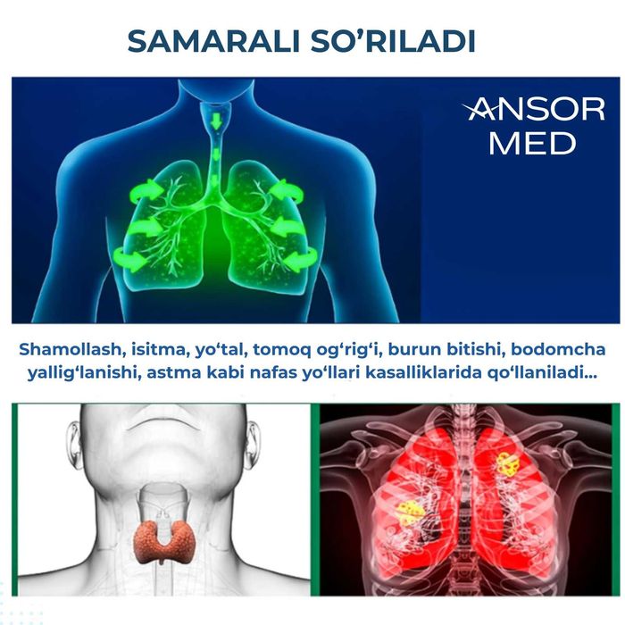 Youwell Ingalyator Astma (KAFOLAT BOR) | Ингалятор (Есть гарантия)