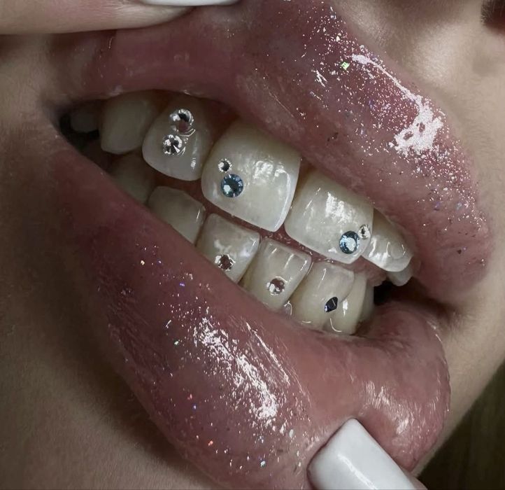 Красивая улыбка уже сегодня | Стоматолог Ташкент