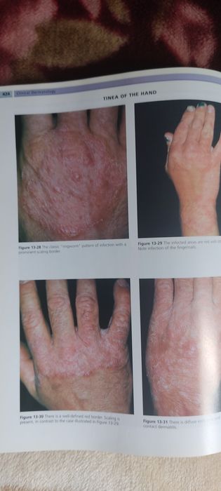 Carte Clinical Dermatology