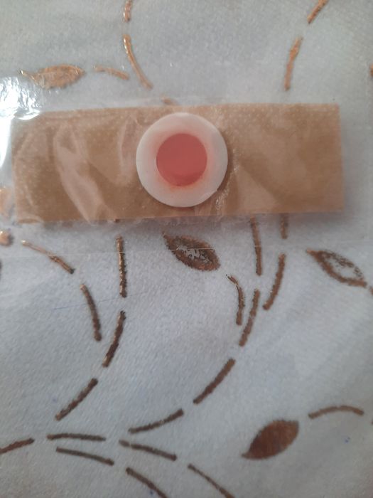 Мозол учун ойёк тагидаги