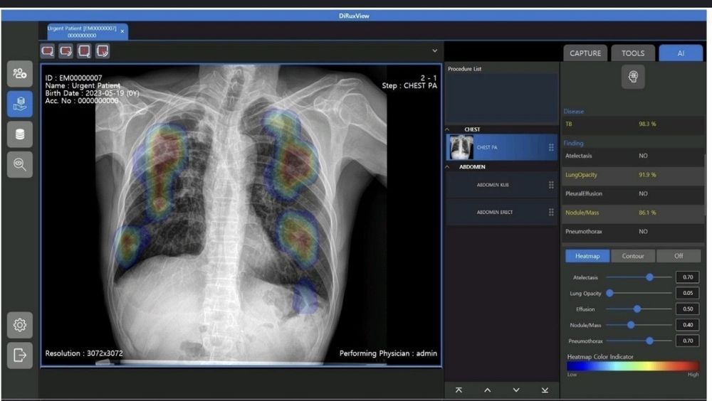 DR  PEDRA 17 FG  с искусственным интеллектом 10.000$