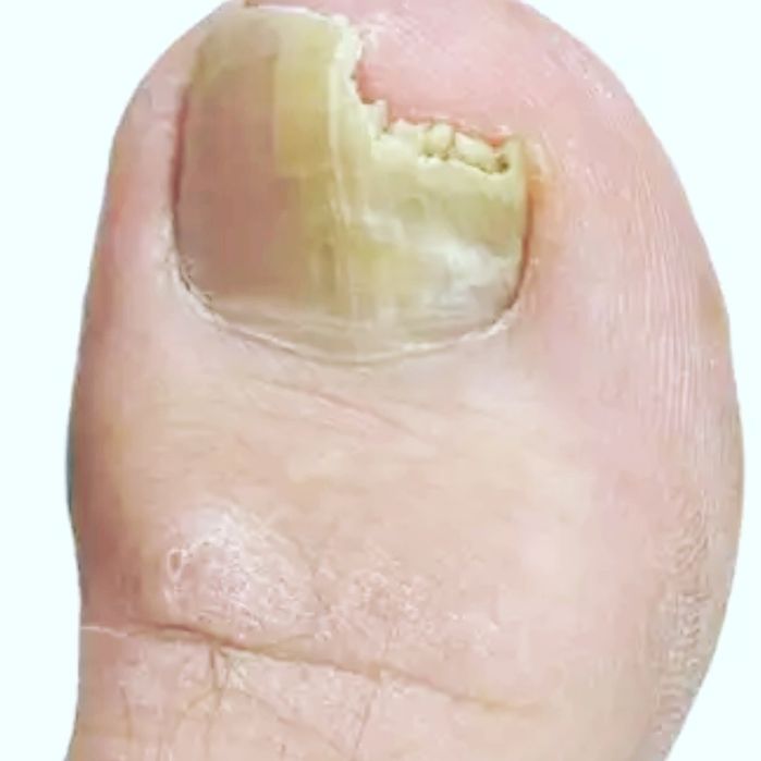 Мужской педикюр маникюр