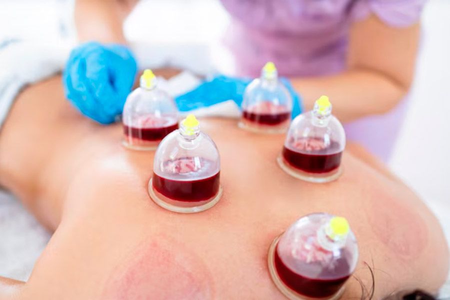 Хиджама хизмати | Услуги хиджамы