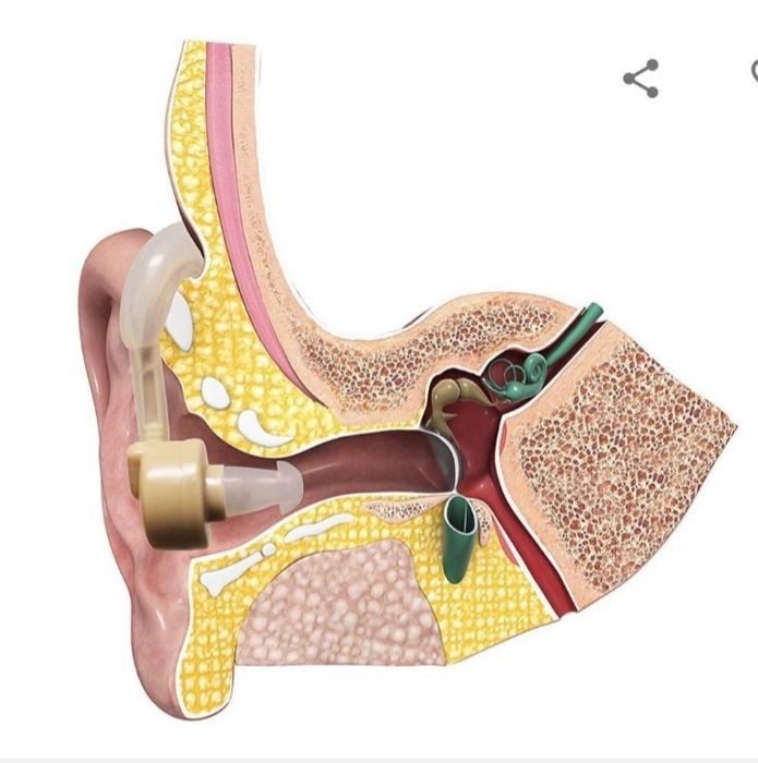 Eshitish moslamasi Syber sonic sound Amplifier / Yetkazib berish bepul