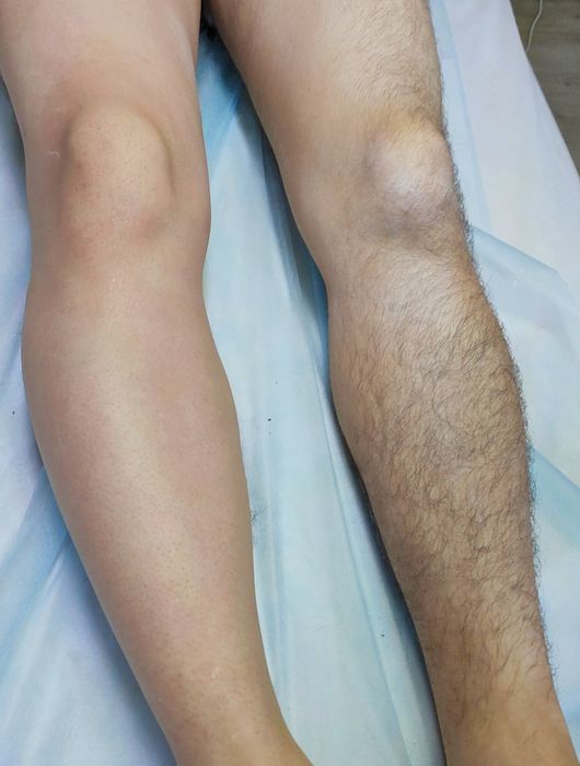 ШУГАРИНГ для всех