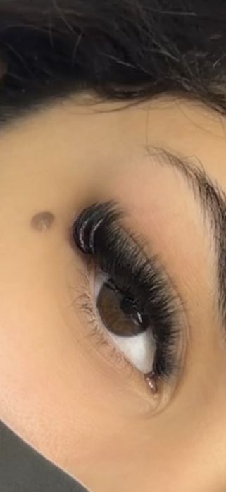 Extensii de gene (volume,1,2,3D)