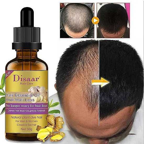 Натурален серум за растеж на косата, Серум против косопад