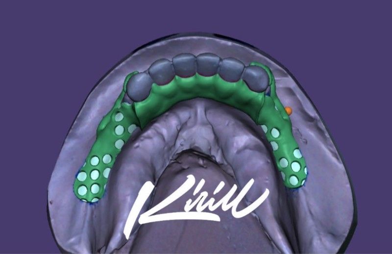 Моделирование зубов (exocad/blender)