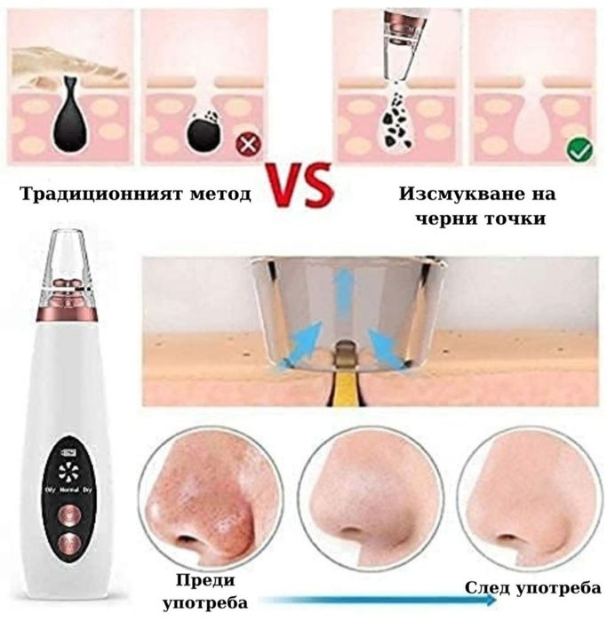 Устройство за грижа за лицето,Черни точки, Акне,6 сменяеми глави