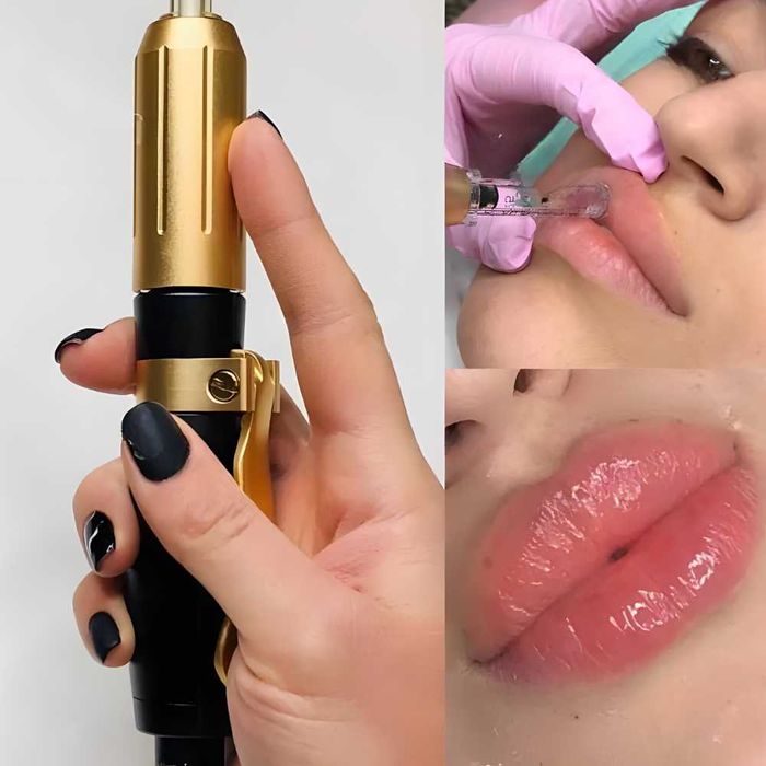 Dispozitiv Premium Reglabil, pentru Aplicarea Acidului Hialuronic