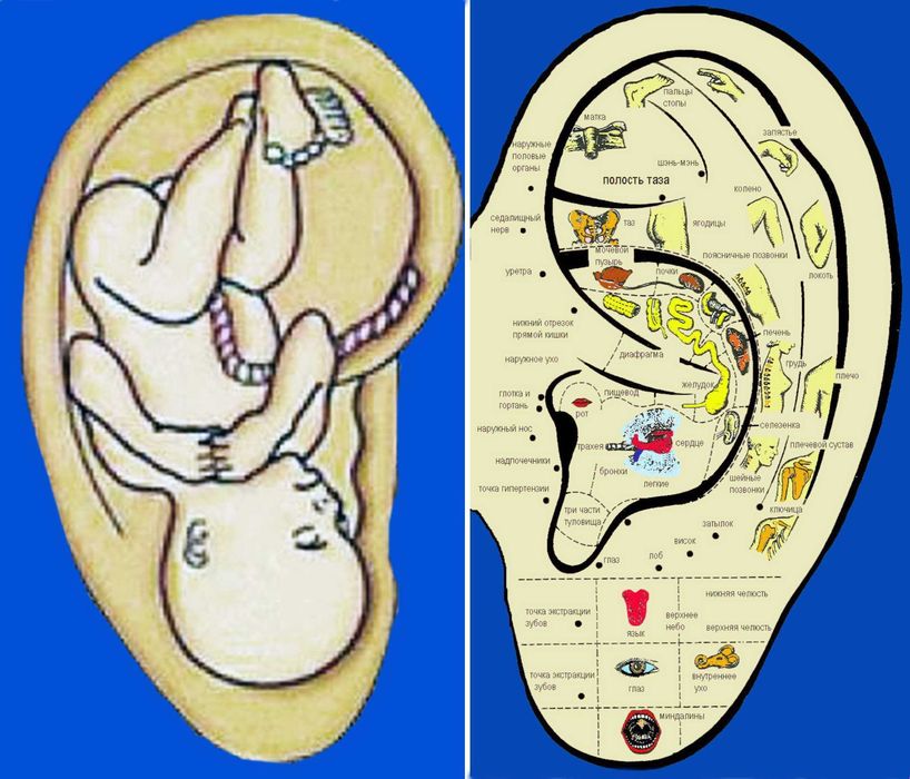 Курс "Диагностика по ушной раковине" - для народных медиков и врачей.