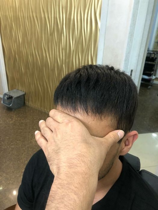 Мужиской протез макушка