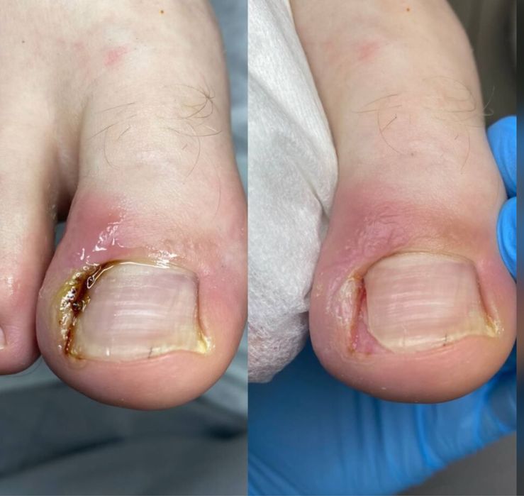 Услуги  подолога