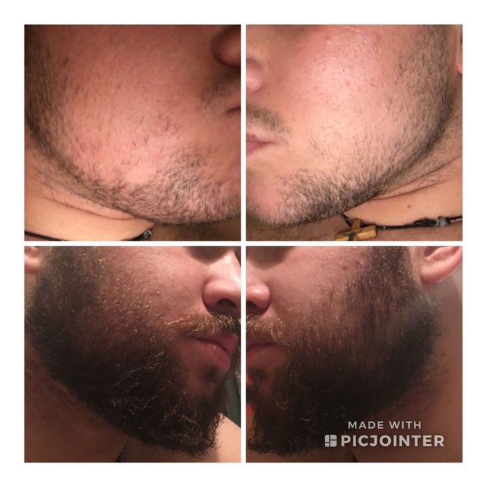 Beard oil soqol o’stiruvchi vosita Original