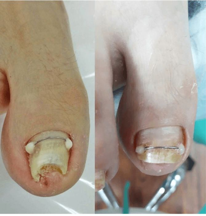 Услуги  подолога