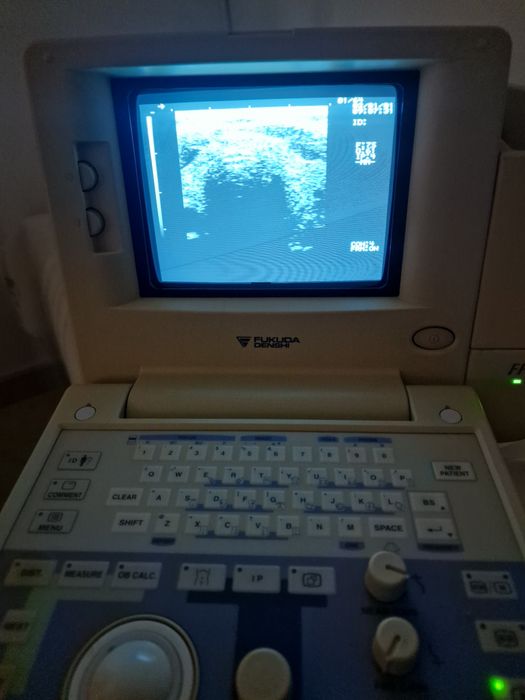 Ecograf portabil Fukuda Denshi FF Sonic UF-4100 – 2 sonde