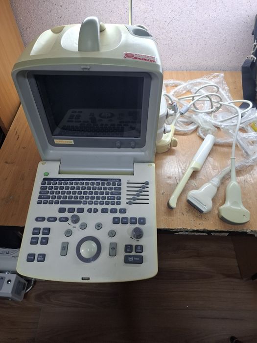 Узи портативний medison sonoace x1
