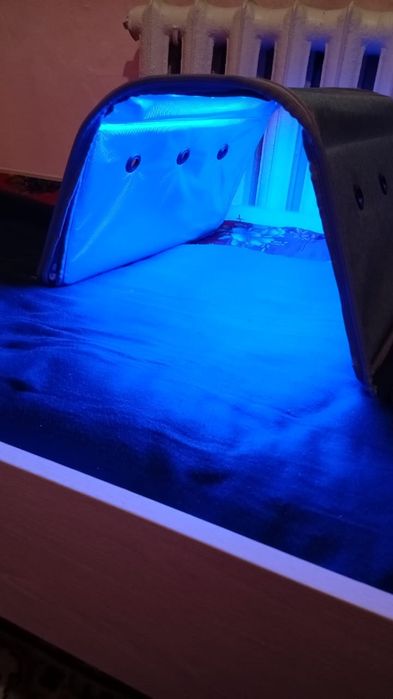 Фотолампа от желтушки