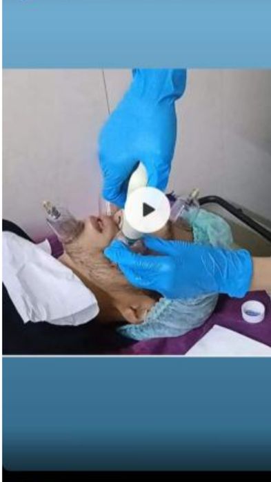 Хиджама, лечение пиявками массаж