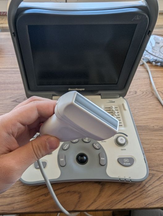 SonoScape A5 – Преносим ехограф с трансдюсер