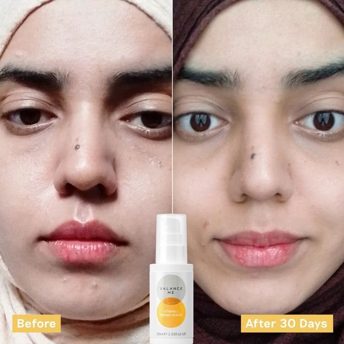 Balance Me серум с витамин C - 7 мл