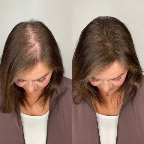 Fibre de par pentru par rar sau chelie - Hairify