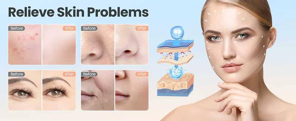 Дарсонвал - Козметичен апарат за повърхностна дезинфекция.