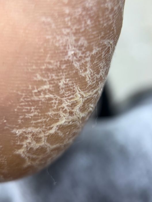 Услуги  подолога