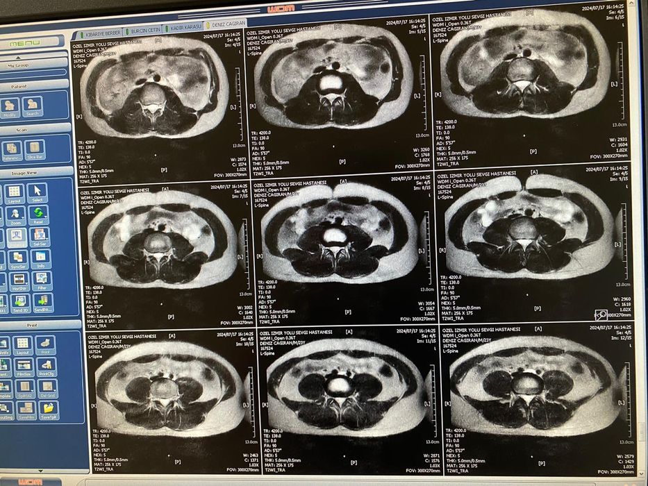 Wandong Open MRI 0.36Tesla (МРТ 0.36T) 2008 Год