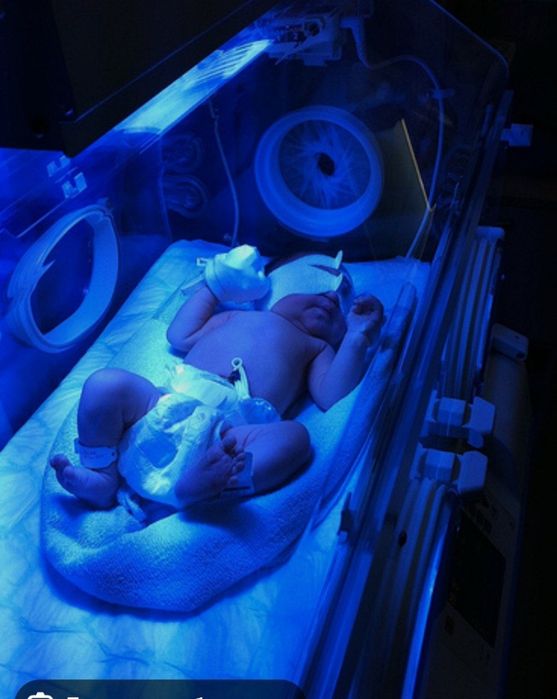 Фотолампа - эффективный метод лечения желтушки у новорожденных