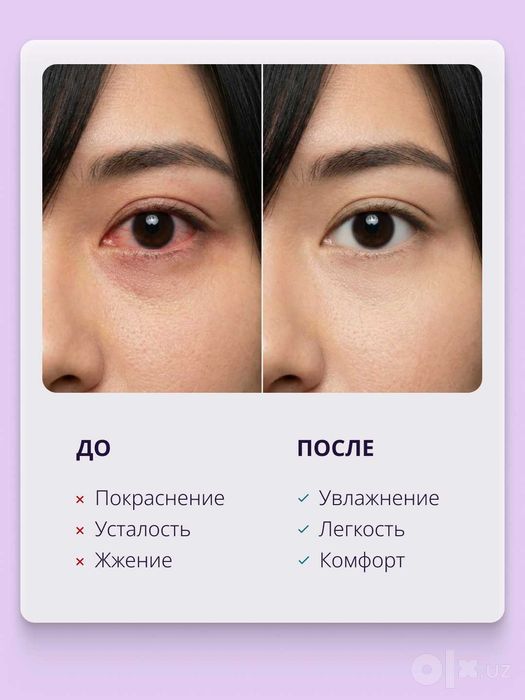 Увлажняющие капли для глаз RELINS ACTIVE с гиалуроновой кислотой, 10мл