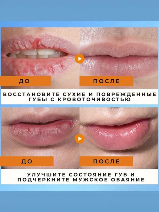 Гигиеническая помада