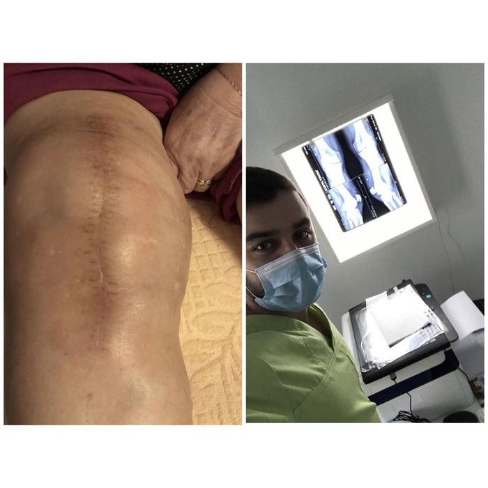 Kinetoterapie la domiciliu